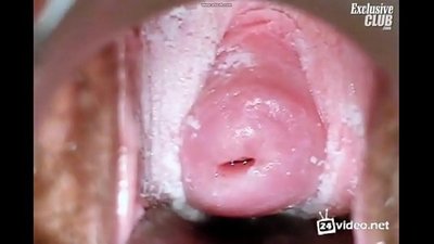 Uchunguzi wa gynecological wa mwanamke mzuri